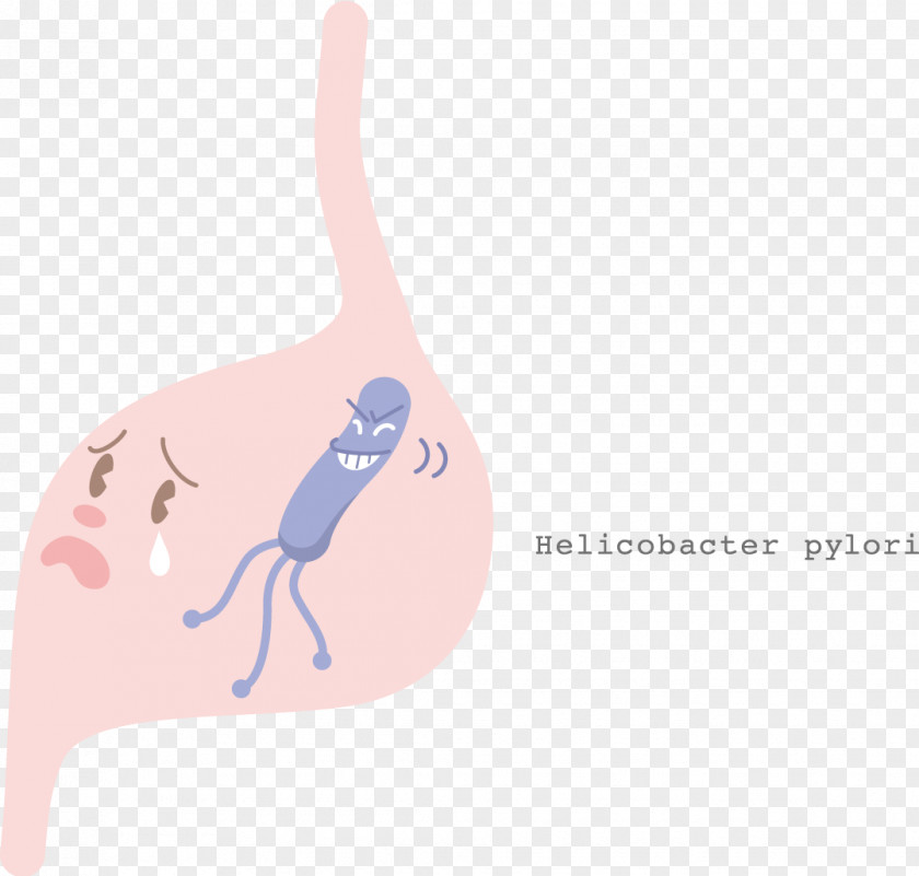 Helicobacter Pylori Stomach Cancer Gastritis Esophagogastroduodenoscopy PNG pylori cancer Esophagogastroduodenoscopy, Eradication Protocols clipart PNG
