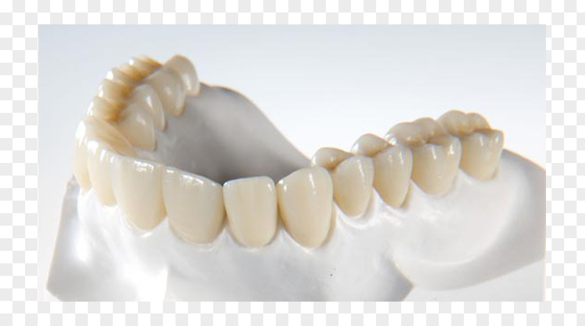Crown Zirconium Dioxide CAD/CAM Dentistry Dental Laboratory PNG