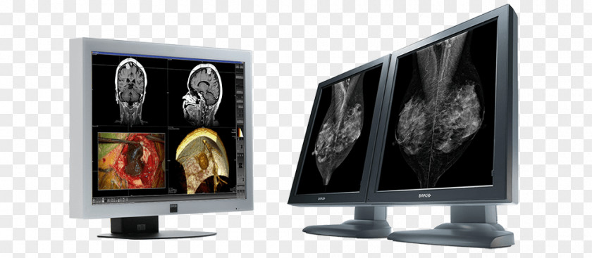 Multimonitor LCD Television Computer Monitors Liquid-crystal Display Barco Coronis 5MP IPS Panel PNG