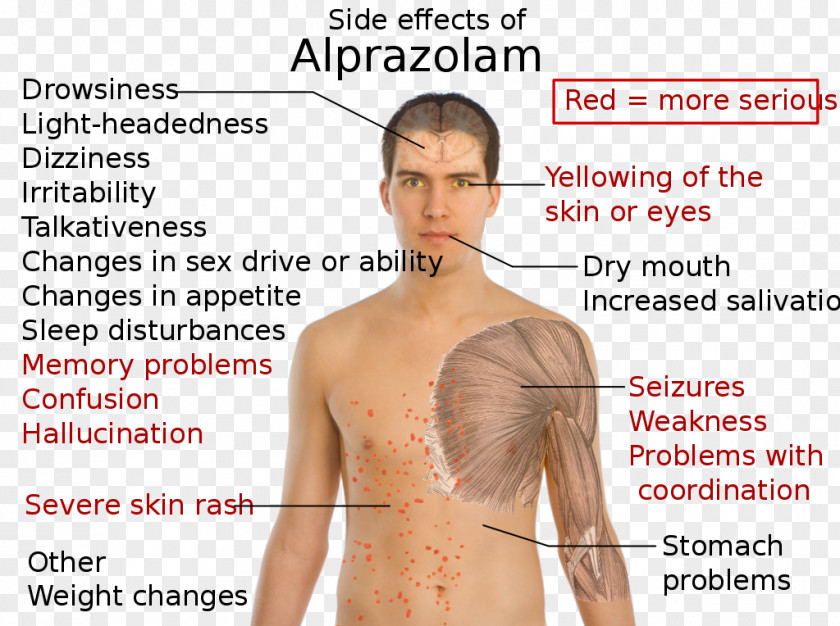 Xanax Alprazolam Adverse Effect Sleep Deprivation Pharmaceutical Drug Diazepam PNG