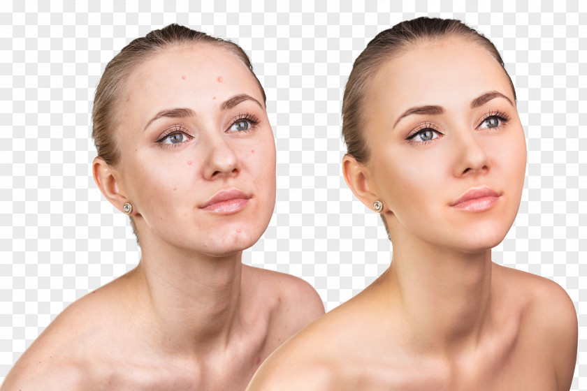 Female Skin Care City Magnolia Day Spa Face Cosmetics Acne PNG