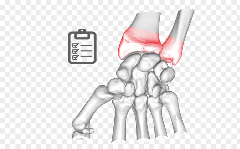Stale Thumb Elbow Bone Ulnar Nerve Joint PNG