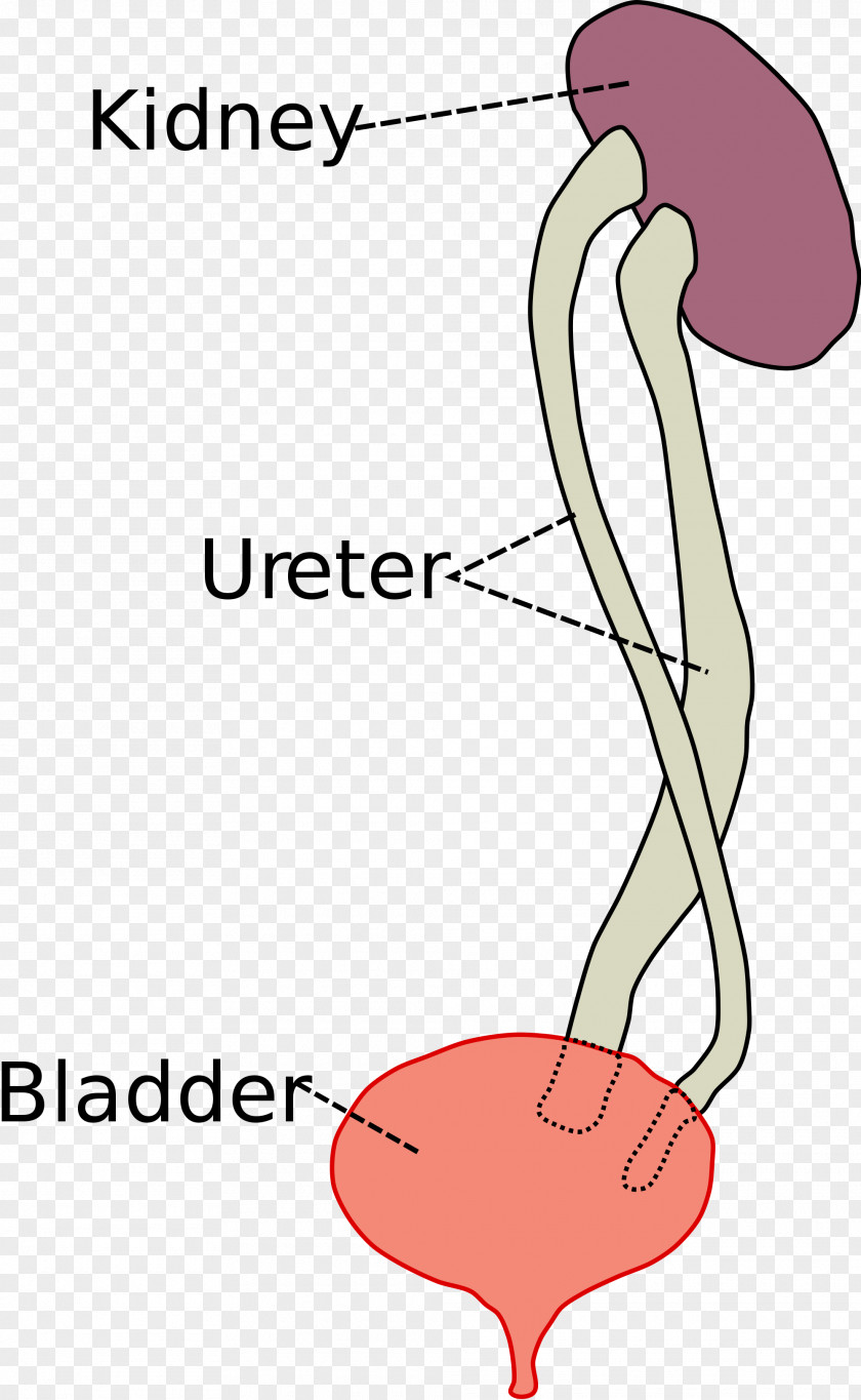 Kidney Duplicated Ureter Urinary Bladder Urethra PNG