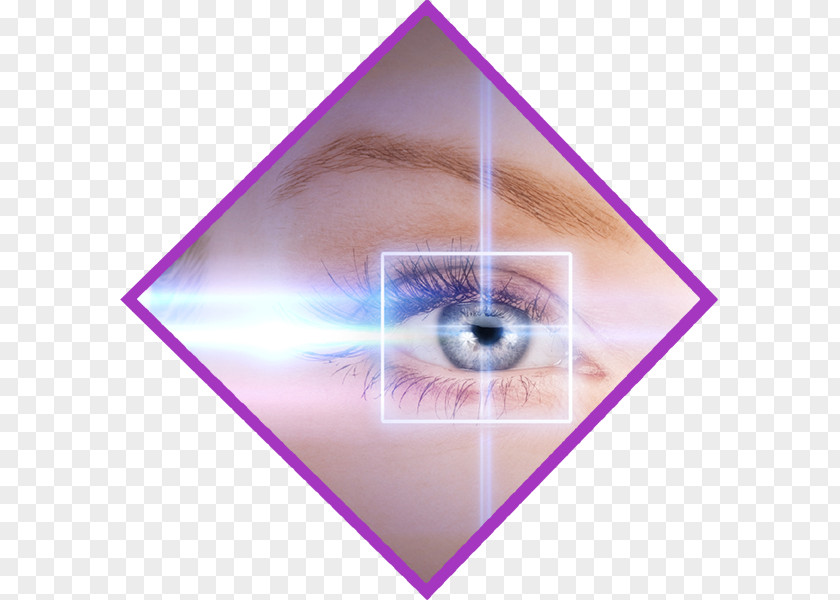 Laser Surgery LASIK Eye Cataract PNG