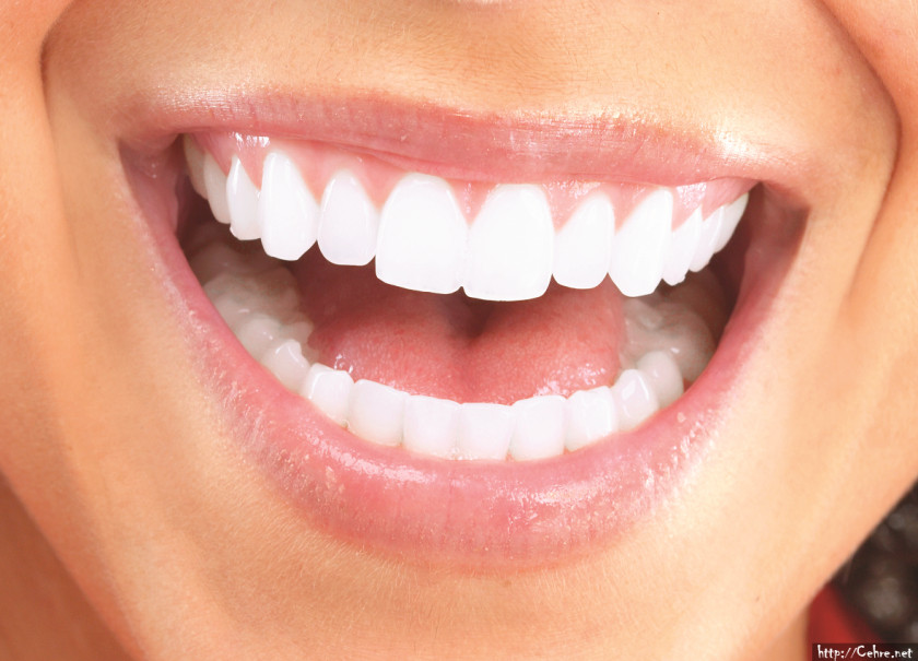 Teeth Cosmetic Dentistry Veneer Dental Restoration Makeover PNG