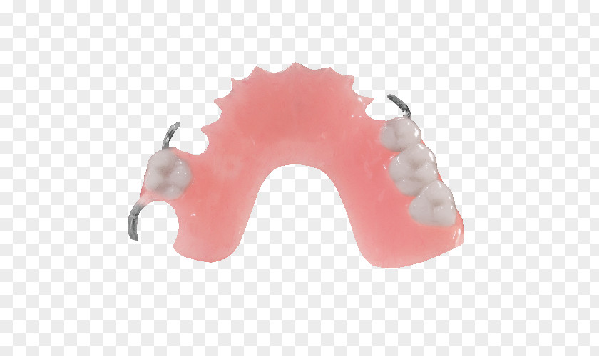 Dentures Removable Partial Denture Dentistry Dental Laboratory Jaw PNG