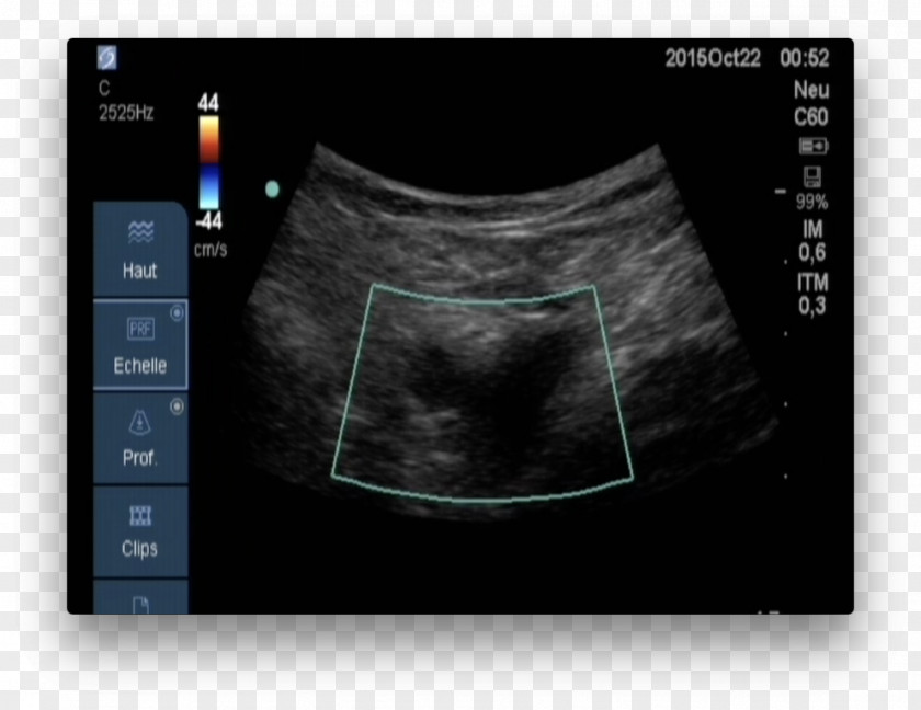 Blood Circulation Medical Imaging Radiology X-ray Magnetic Resonance Biomedical Engineering PNG