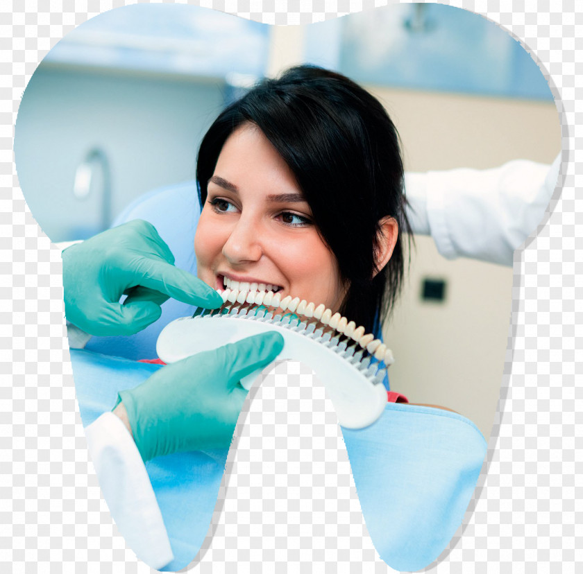 Tooth Whitening Dentistry Veneer PNG