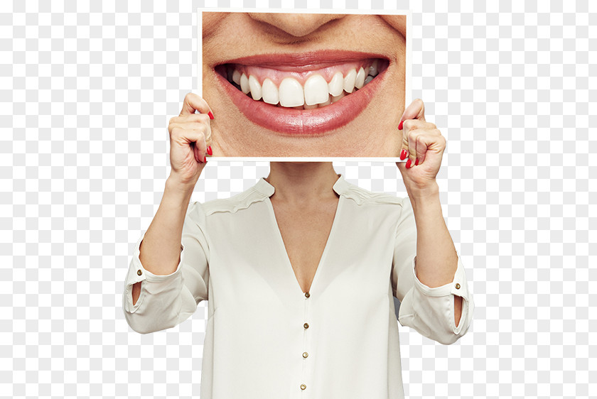 Crown Cosmetic Dentistry Veneer Dental Implant PNG
