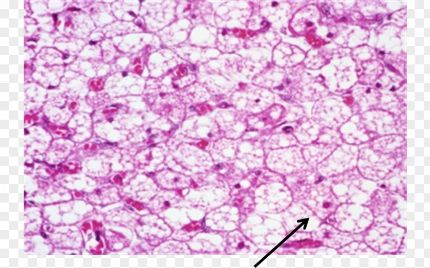 Brown Adipose Tissue Histology Connective PNG