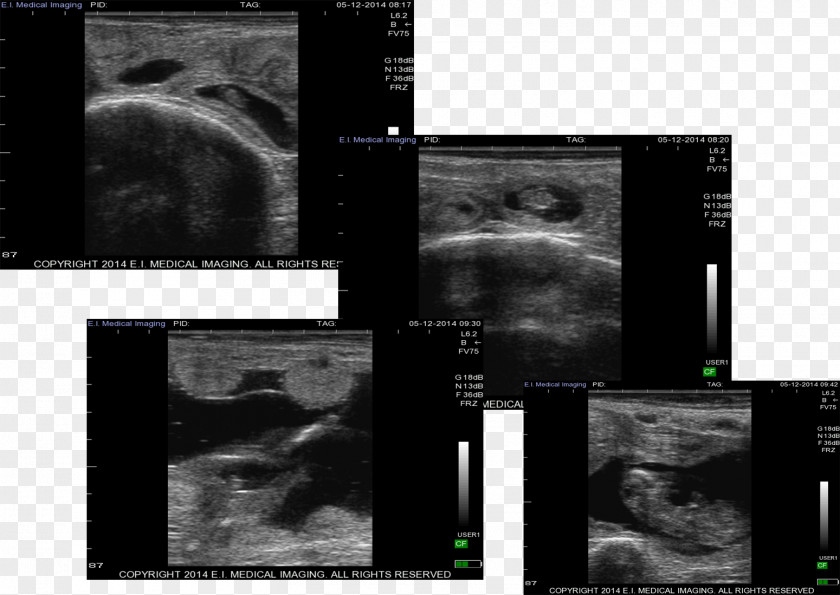 Computer Medical Imaging Radiology Desktop Wallpaper Screenshot Medicine PNG