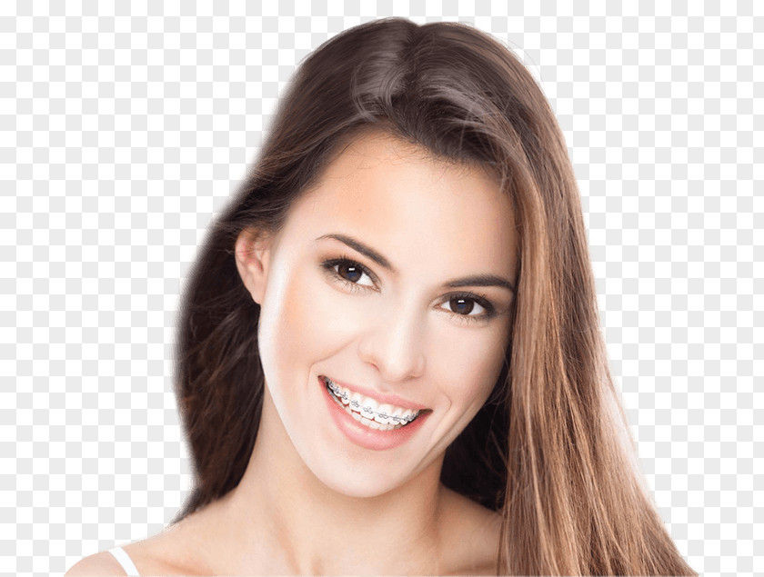 Braces Dental Clear Aligners Cosmetic Dentistry Orthodontics PNG