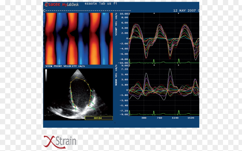 Strain Cardiology Cardiovascular Disease Clinic Colombia Veterinary Medicine PNG