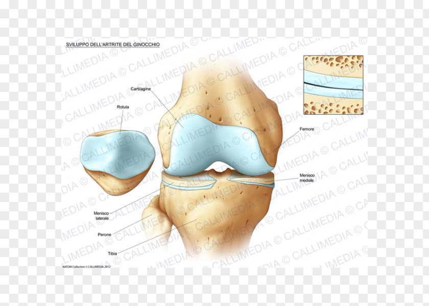Ear Knee Osteoarthritis Anatomy Bone Fracture PNG