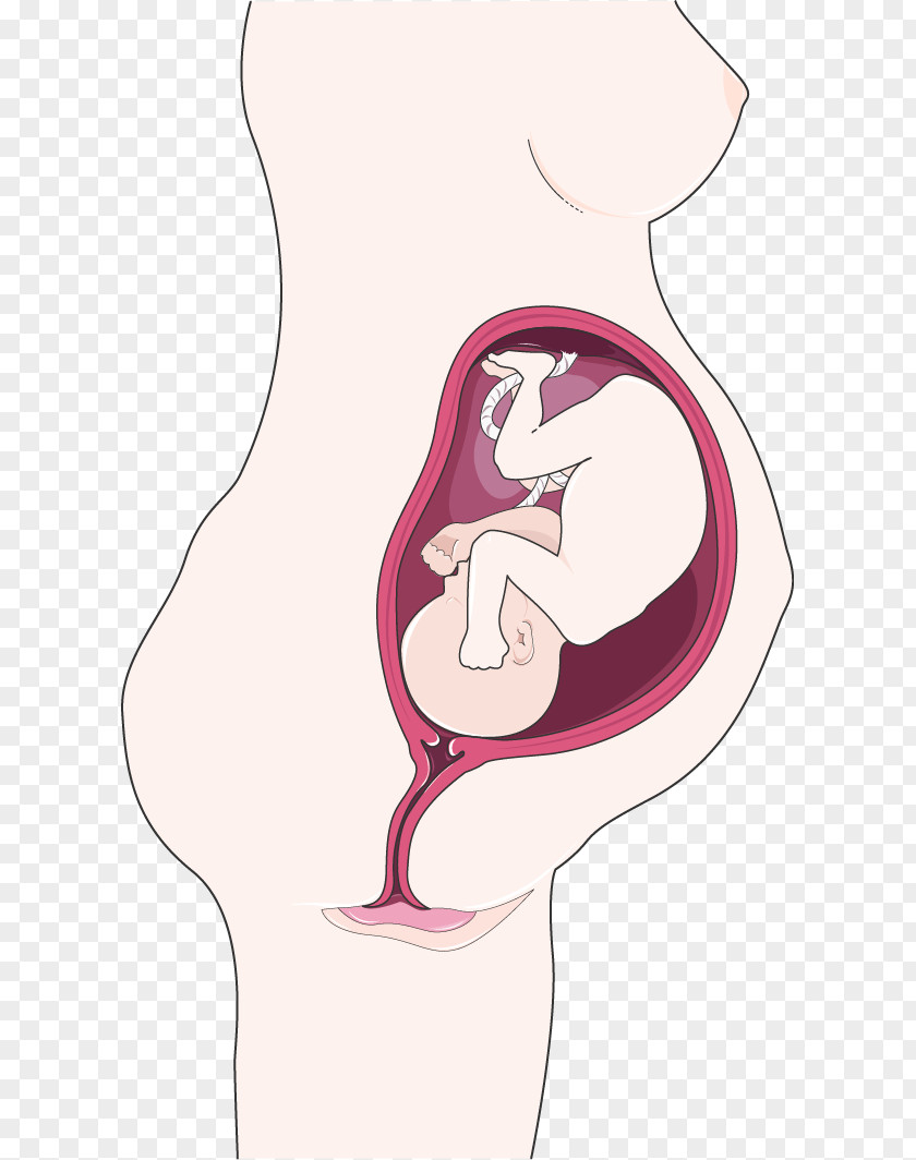 Pregnancy Fetus Immune System Shoulder Dystocia Anterior PNG