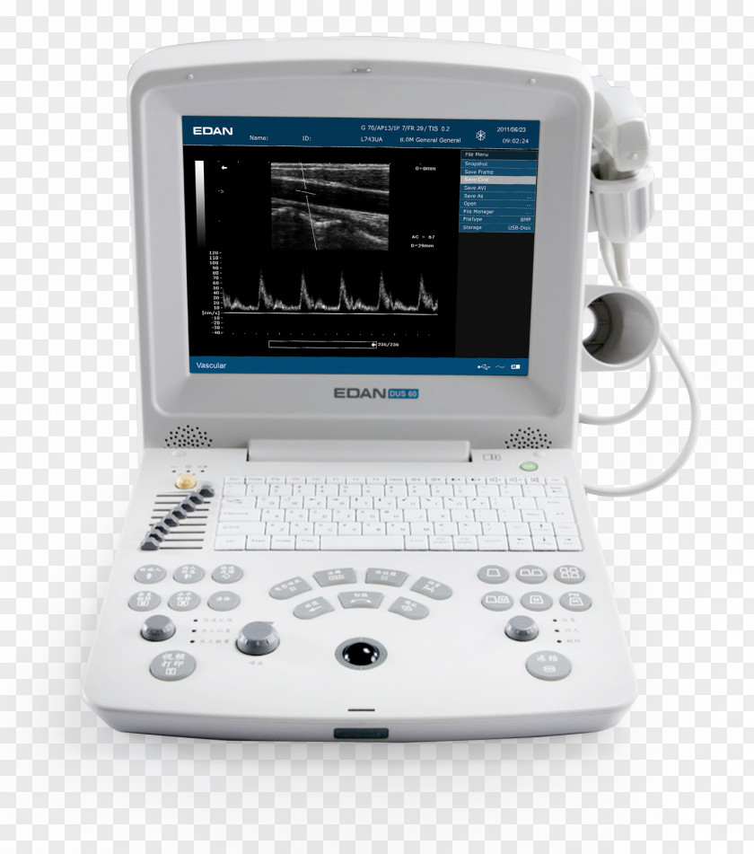 Ultrasonography Ultrasound Medical Imaging Electrocardiography Mindray PNG
