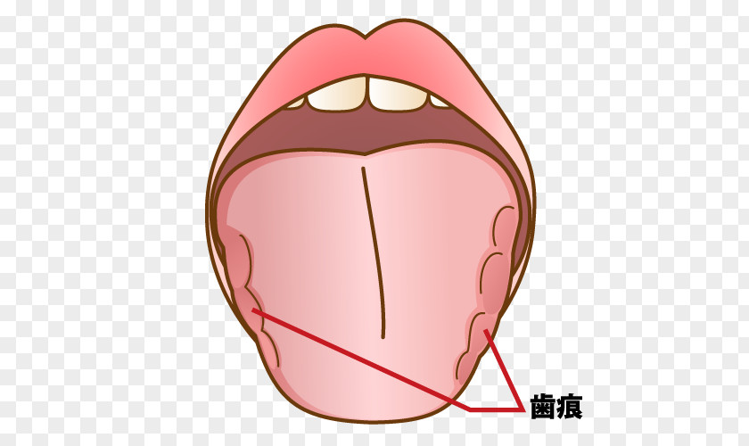 Captions Mouth Dentist Jaw Tooth 坂井歯科医院 PNG