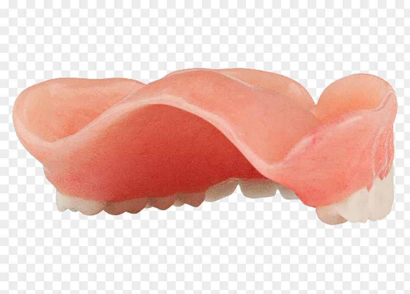 High Grade Shading Dentures Removable Partial Denture Dental Laboratory Mouth The Mirage PNG