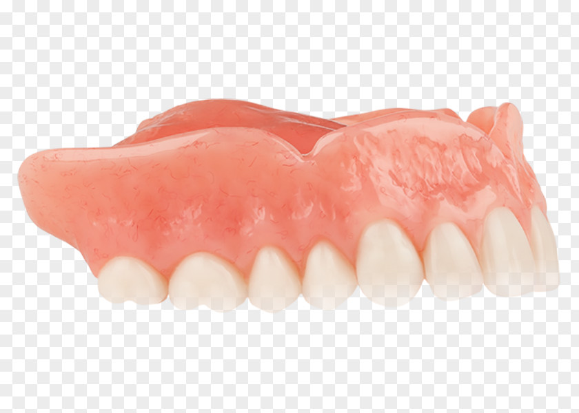 Aspen Dental Tooth Dentures Dentistry YouTube PNG