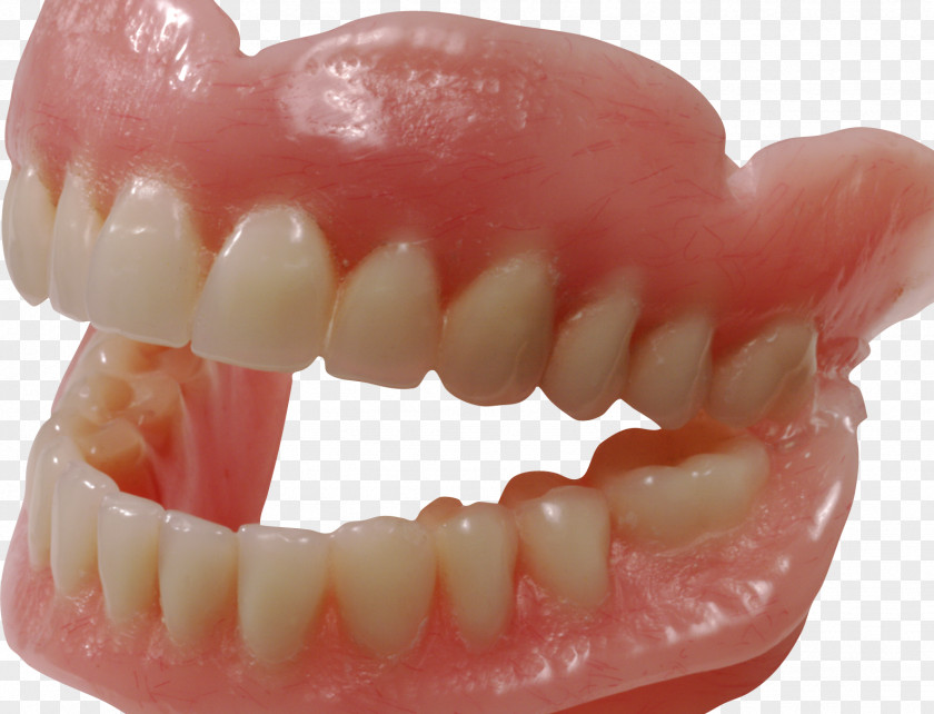 Tooth Human Dentures Clip Art PNG