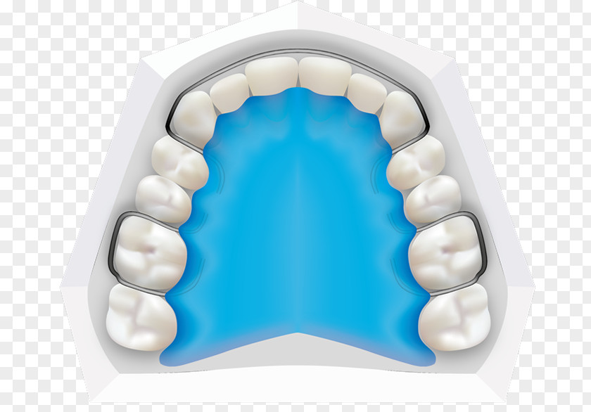 Tooth Orthodontics Dental Braces Dentistry Orthodontist PNG
