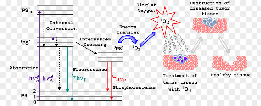 Cartoon Cancer Cell Photodynamic Therapy Singlet Oxygen Jablonski Diagram Photosensitizer PNG