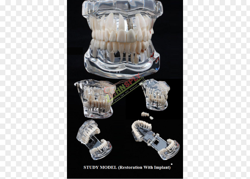 Study Supplies Tooth Decay Jaw Dentistry Bridge PNG