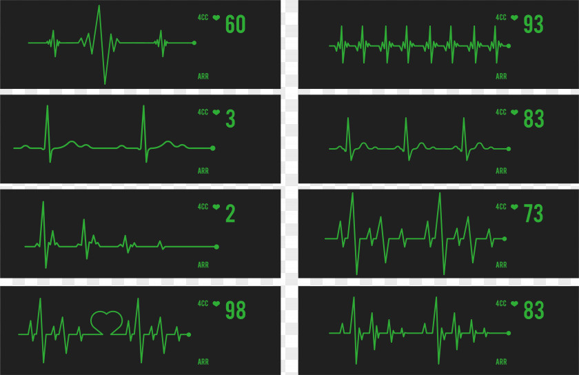 ECG Monitor Heartbeat Detection Green Technology Angle Area Font PNG