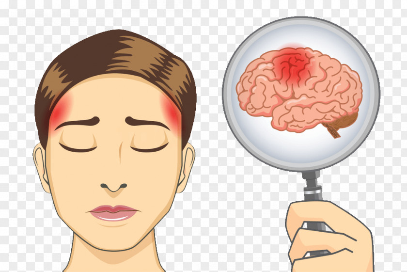 Brain Human Worry Headache Stroke PNG