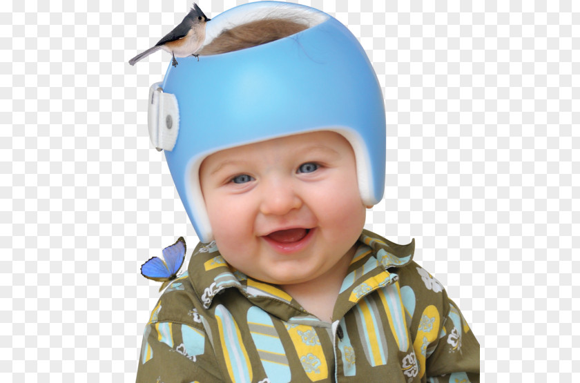 Skull Orthotics Helmet Plagiocephaly Hard Hats PNG