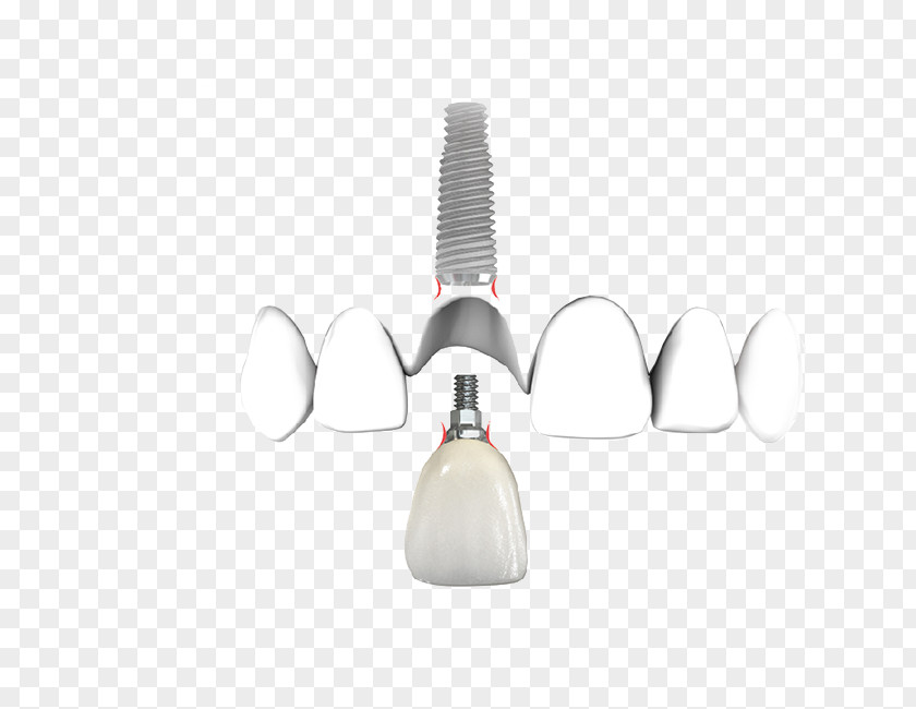 Implants Bridge Dentistry Dental Implant Product Design PNG