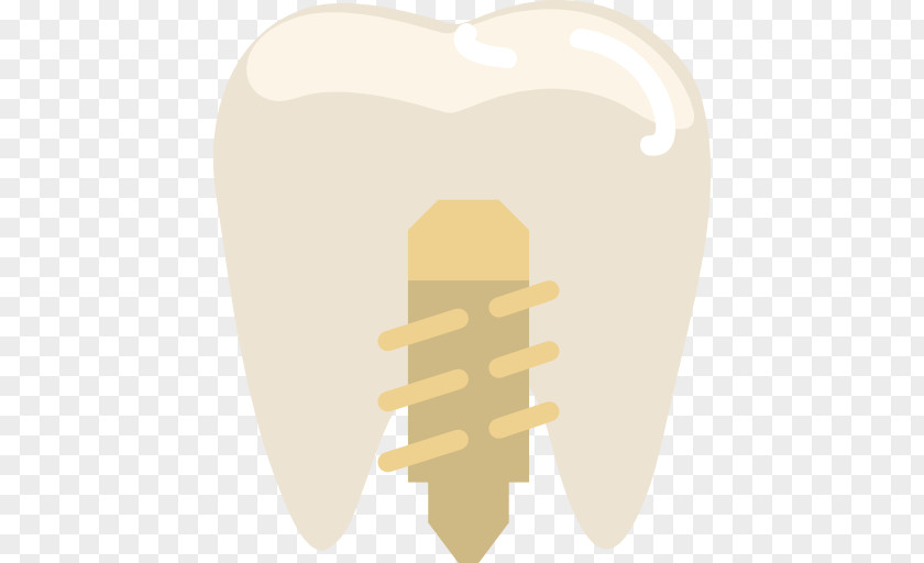 Implants Tooth Dentistry PNG