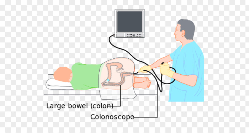 Anxious Patient Nurse Colonoscopy Wiring Diagram Large Intestine Diverticulosis PNG
