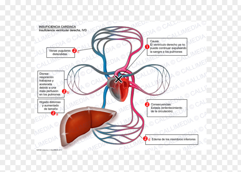 Heart Failure Systole Cardiology Symptom Ventricle PNG
