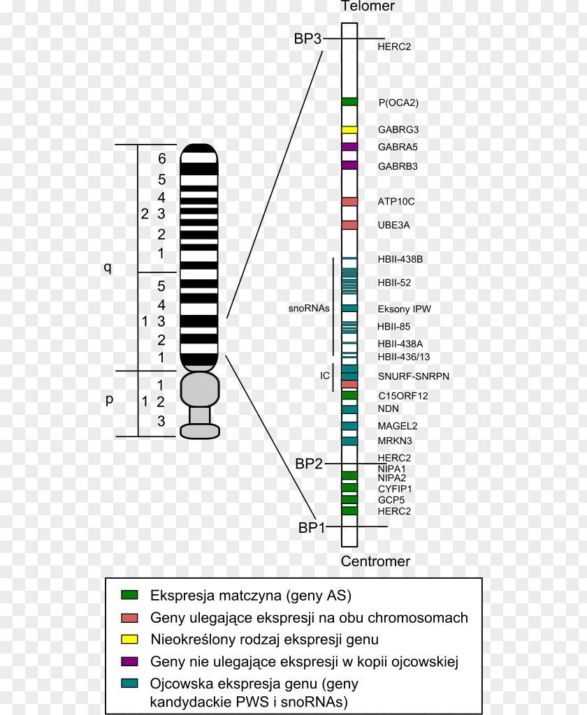 Scoliosis Genetic Disorder Chromosome Disease Down Syndrome PNG