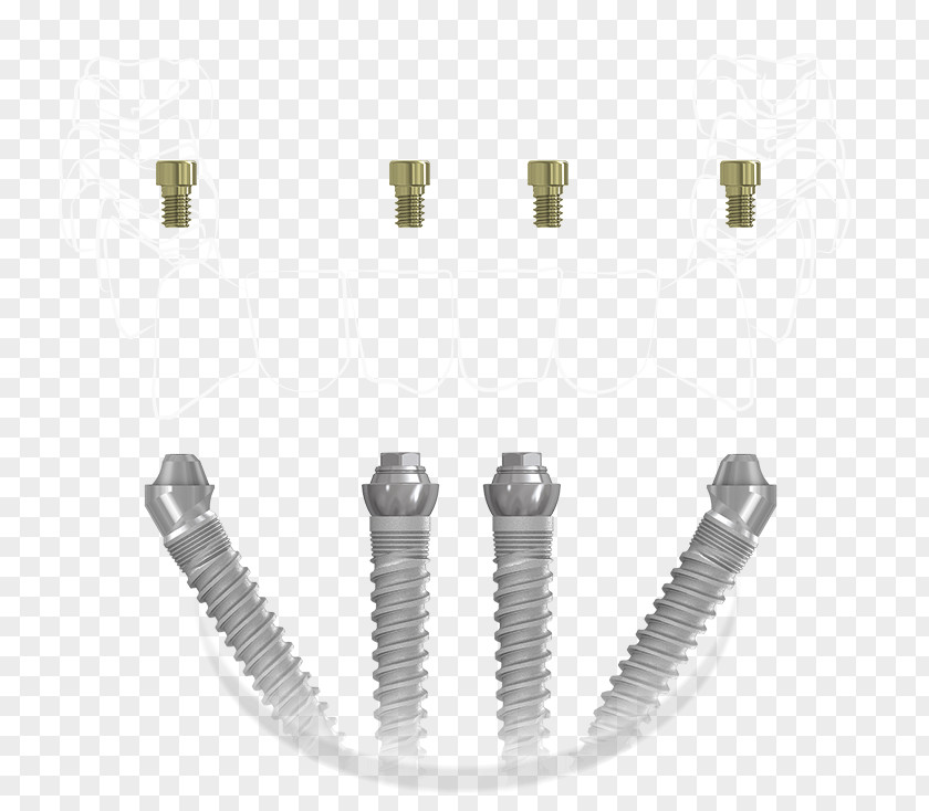 Japan Impression Dental Implant System Of Measurement Information Dentistry PNG