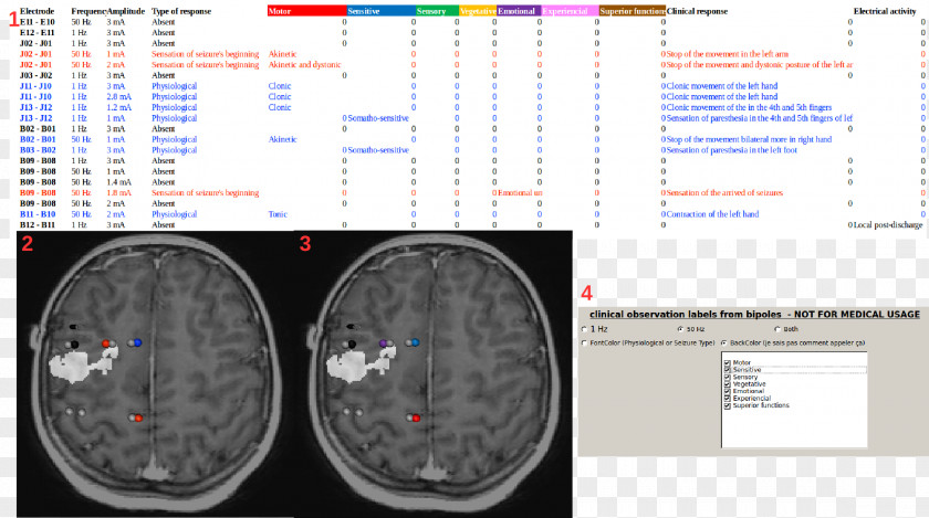 Brain Medical Imaging Positron Emission Tomography Magnetic Resonance Electrode PNG