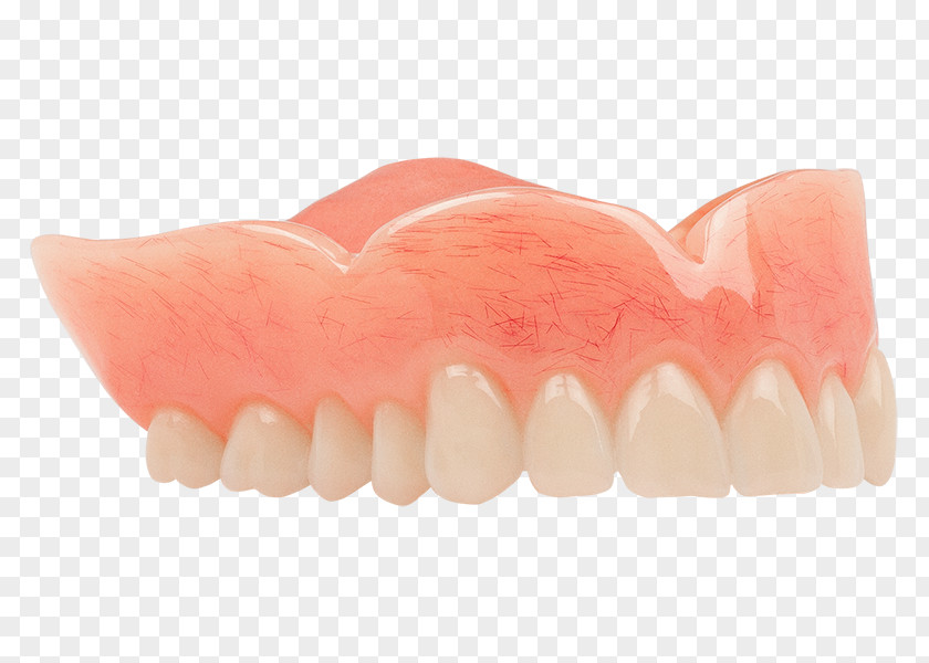 Dentures Tooth Dentistry Aspen Dental Acrylic Resin PNG