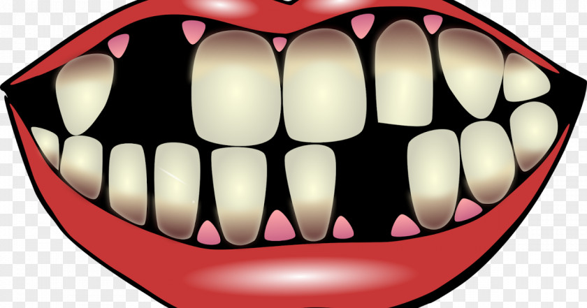 Smile Tooth Loss Human Clip Art PNG