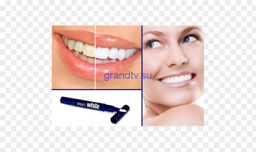 Health Tooth Whitening Dentistry Dental Surgery PNG
