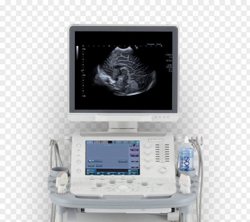 Ultrasonography Ultrasound Medical Diagnosis Patient Mindray PNG