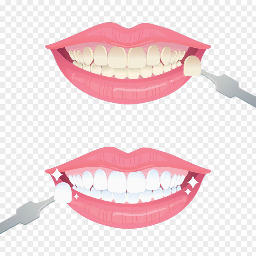 Hand Painted Teeth Whitening Tooth Euclidean Vector PNG