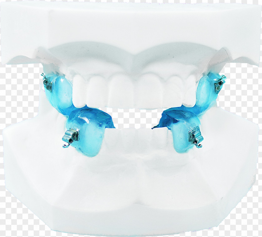 Rabbit Teeth Jaw Orthodontics Dental Braces Twin Block Appliance Therapy PNG