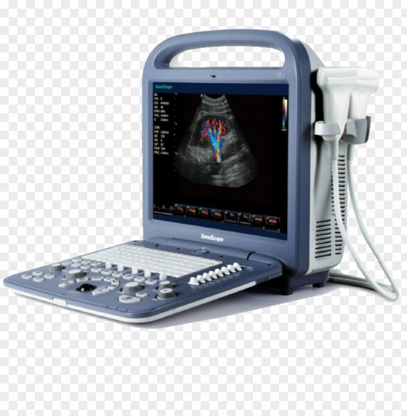 Practical And Colorful Inkstone Doppler Echocardiography Portable Ultrasound Ultrasonography SonoScape Medical Corp PNG
