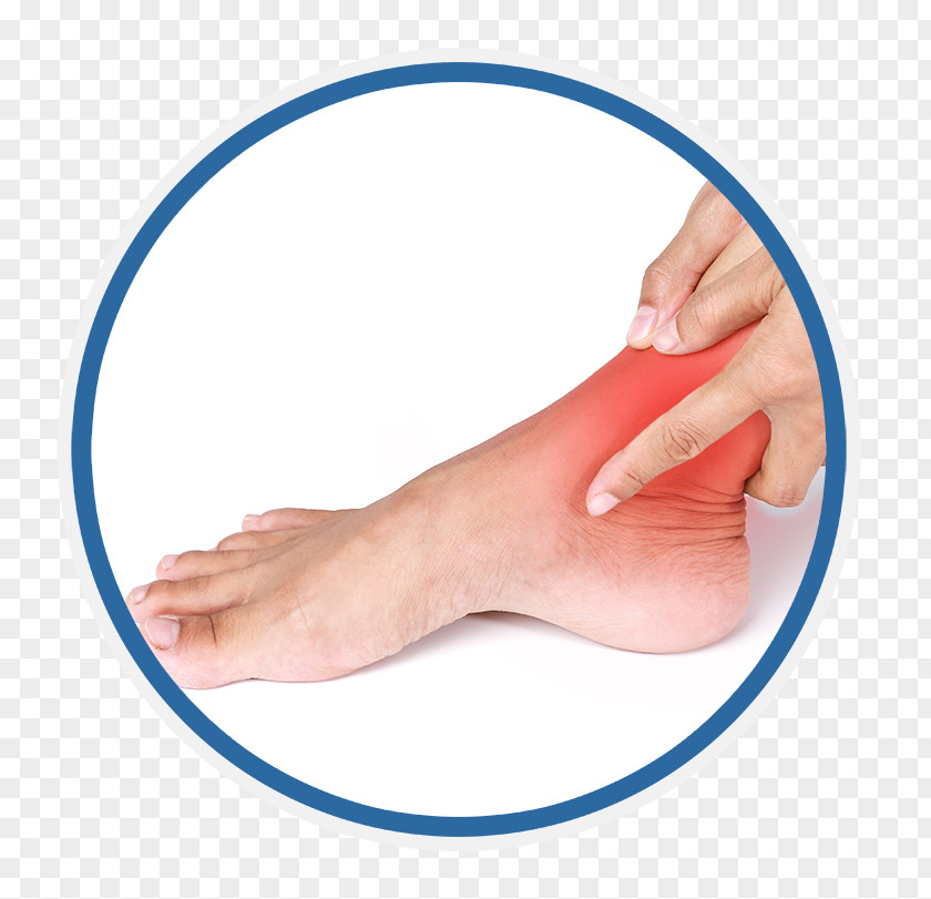Sprained Ankle Pain Injury PNG