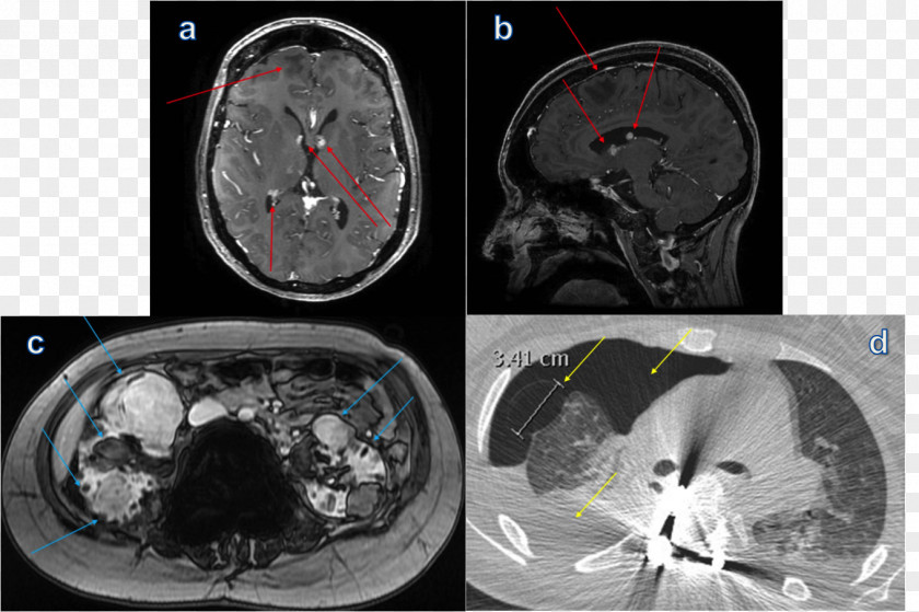 Computed Tomography Radiology Organism Brain PNG