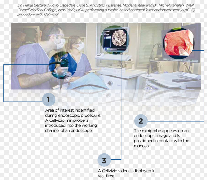 Barrett's Esophagus Endomicroscopy Confocal Microscopy Biopsi Endoscopy Colonoscopy PNG