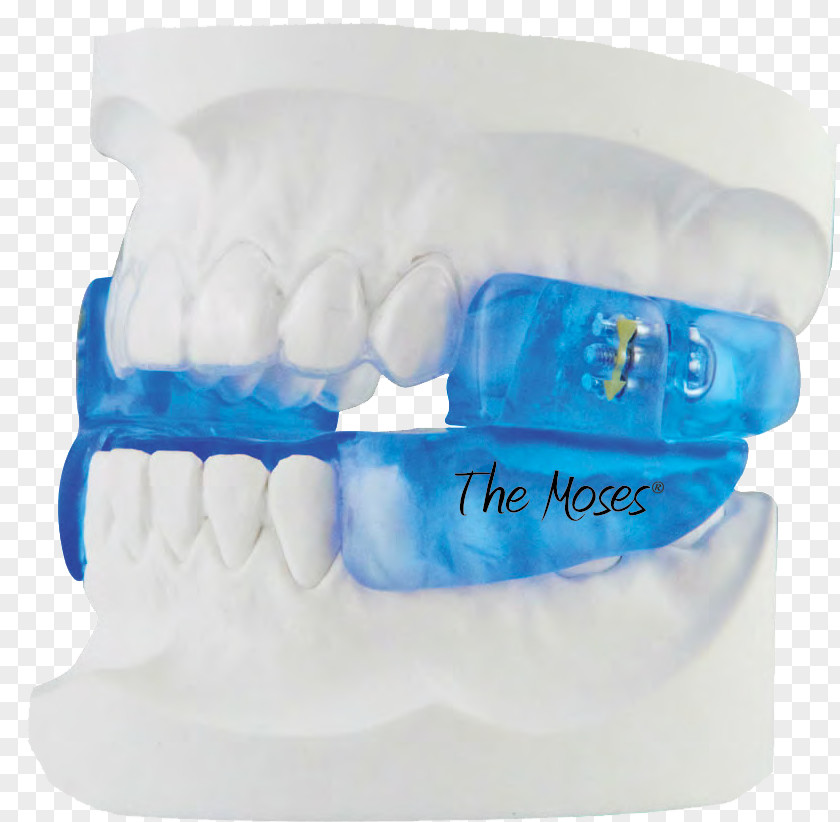 Dental Architecture And Therapy Mandibular Advancement Splint Obstructive Sleep Apnea Dentist PNG