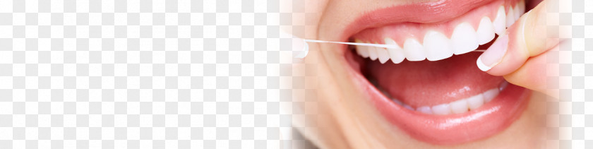 Health Dentistry Gingivitis Tooth Mouth PNG