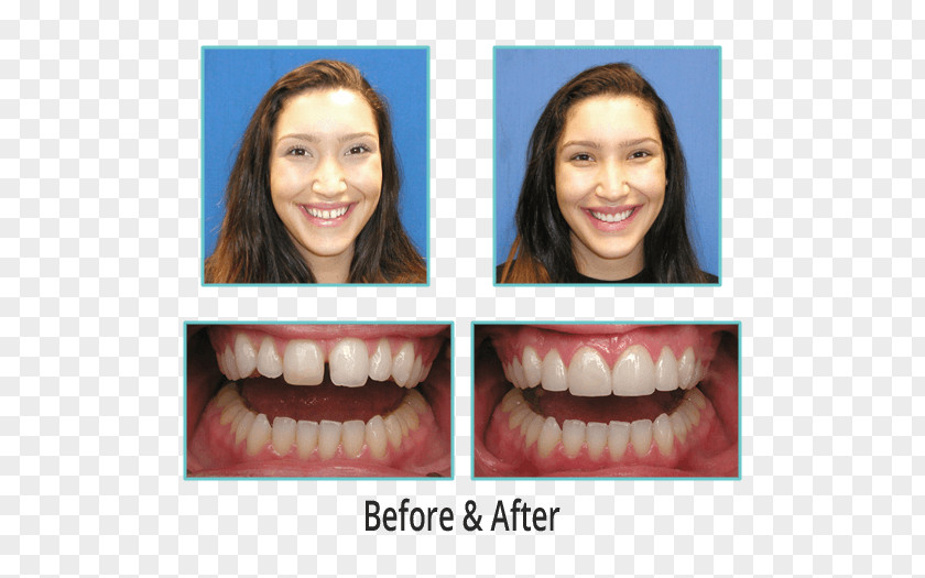 Dental Smile Close-up Health PNG